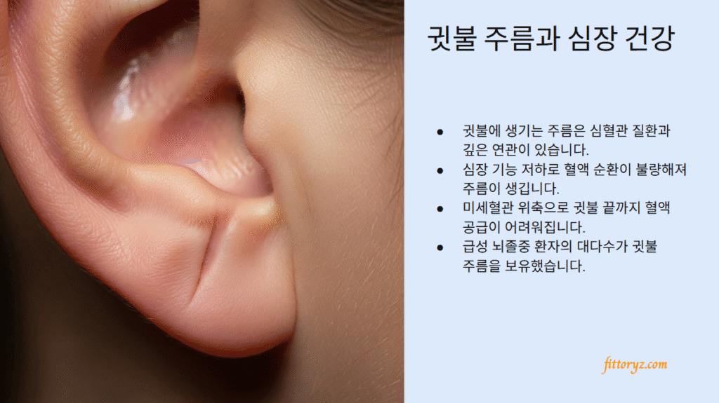 귓불주름과 심장 건강
-귓불에 생기는 주름은 심혈관 질환과 깊은 연관이 있습니다.
-심장 기능 저하로 렬액 순환이 불량해져 주름이 생깁니다.
-미세혈관 위축으로 귓불 끝까지 혈액 공급이 어려워집니다.
-급성 뇌졸중 환자의 대다수가 귓불 주름을 보유했습니다.